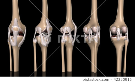 List by knee joint orientation 42230915