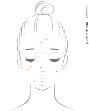 女性患有痤瘡 女性患有痤瘡 42244889