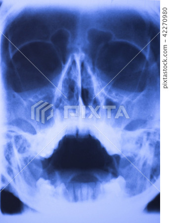 Medical xray face scan Medical xray face scan 42270980