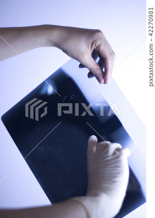Xray breast scan mammogram Xray breast scan mammogram 42270981