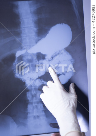 Medical xray spine hip scan Medical xray spine hip scan 42270982