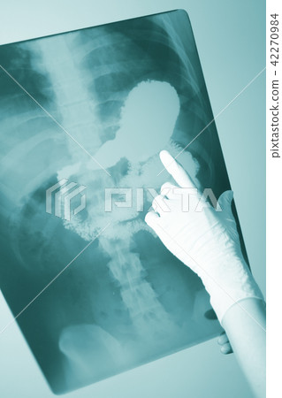 Medical xray spine hip scan 42270984