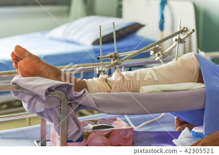 Orthopedic treatment Bone surgery of patients 42305521