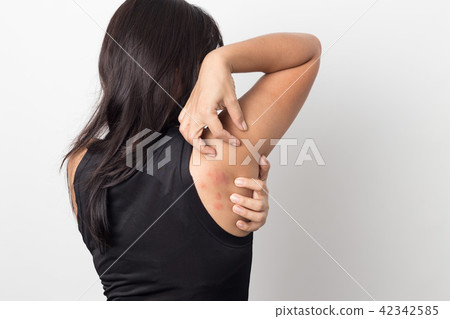 woman showing her skin itching behind  42342585