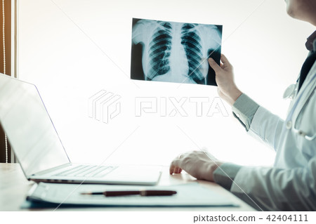 Doctor holding x-ray film at lap hospital office. 42404111