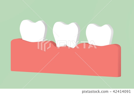 tooth periodontitis or gingivitis, gum disease 42414091