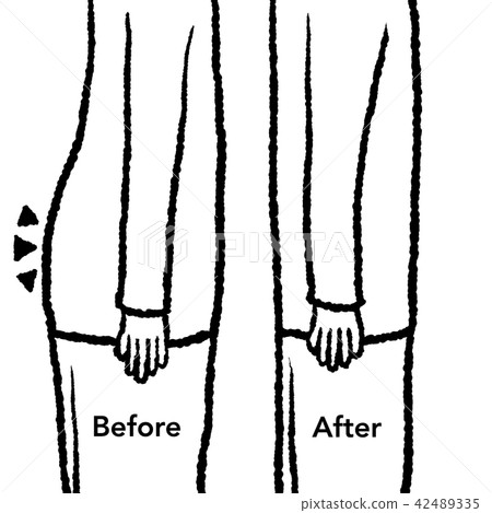 stomach stomach 42489335