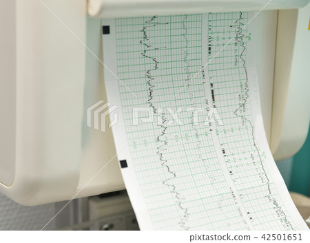 Monitor for measuring contractions, heartbeat of a pregnant woman 42501651