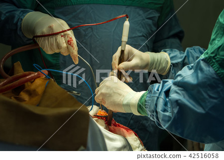 Operation of trepanation of the skull. 42516058