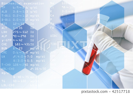 Medical image blood test Medical image blood test 42517718