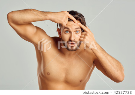 Shocked Man Looking At Pimple On Forehead. Shocked Man Looking At Pimple On Forehead. 42527728