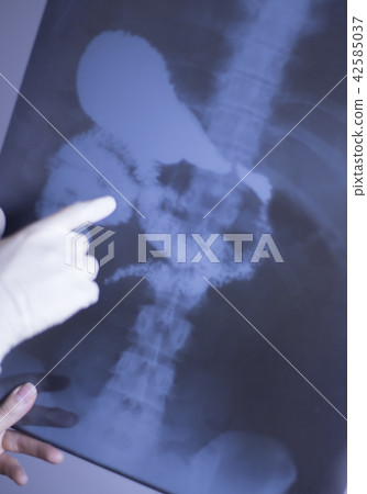 Medical xray spine hip scan Medical xray spine hip scan 42585037