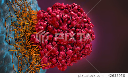 3d illustration of a brain cancer cell 3d illustration of a brain cancer cell 42632958