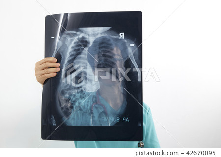 Doctors examining x-ray of chest 42670095