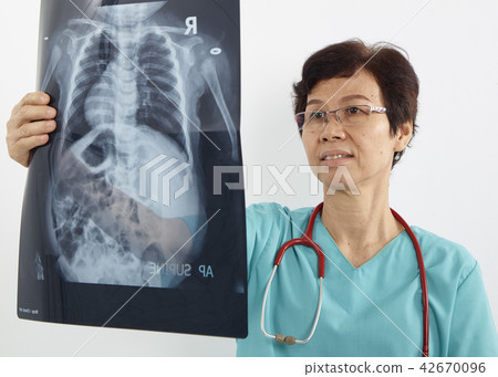 Doctors examining x-ray of chest Doctors examining x-ray of chest 42670096