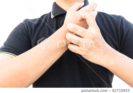 Man scratching allergic skin isolated on white Man scratching allergic skin isolated on white 42710935