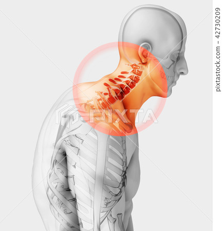 Neck painful - cervical spine, 3D illustration. Neck painful - cervical spine, 3D illustration. 42730209