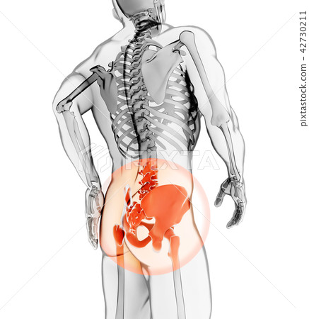 Hip painful skeleton x-ray, 3D illustration. 42730211