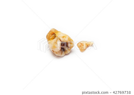 Broken Caries Molar on the iSolated White. Broken Caries Molar on the iSolated White. 42769738