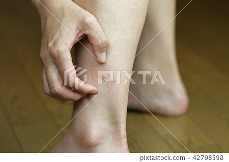 Insect bites 42798598