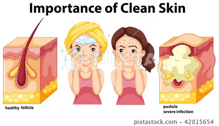 Importance of clean skin concept Importance of clean skin concept 42815654