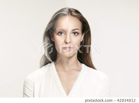 Comparison. Portrait of beautiful woman with problem and clean skin, aging and youth concept, beauty 42834812