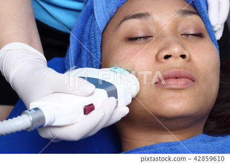 Treatment on Asian Woman as patient to make skin smooth bright and cure acne with medical beauty device instrument cold process on face in hospital clinic 42859610