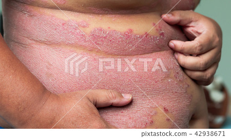 Men is holding the belly and scratching the area o Men is holding the belly and scratching the area o 42938671