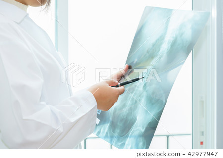 doctor examining about lungs with x-ray film doctor examining about lungs with x-ray film 42977947