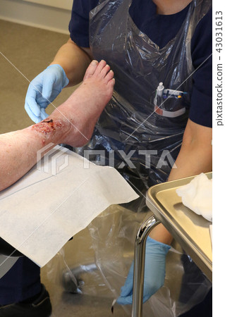 Wound on the leg Wound on the leg 43031613