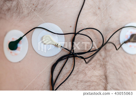 Holter monitor device on human male body. Daily cardiogram examination. Excess fat person. High risk 43055063