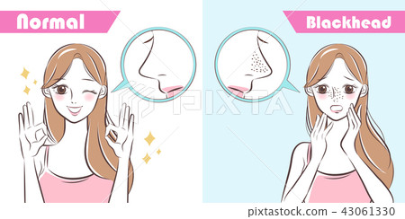 woman with blackhead problem 43061330