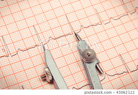 Electrocardiogram graph report with calipers 43062122