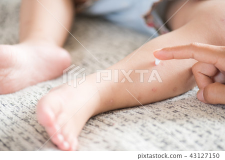 Mother applying cream on a girl's legs 43127150