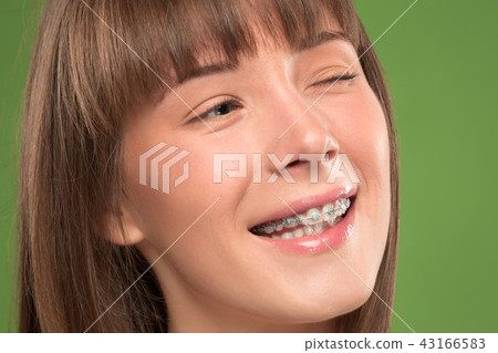 Beautiful young woman with teeth braces Beautiful young woman with teeth braces 43166583