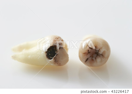 Caries Caries 43226417