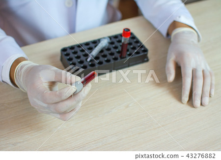 doctor holds a blood sample tube in his hand testi 43276882