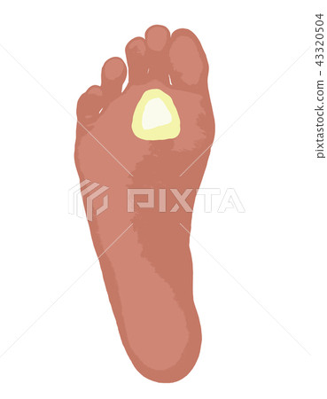 Tako foot sole 43320504