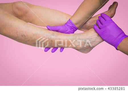 Lower limb vascular examination because suspect of venous insufficiency 43385281