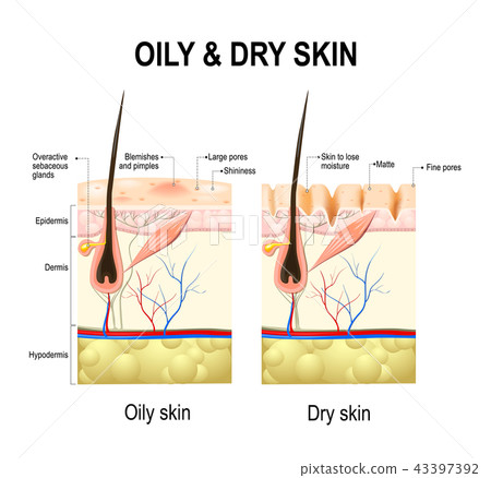 Oily & dry skin 43397392