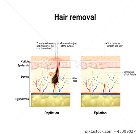 epilation and depilation difference epilation and depilation difference 43399027