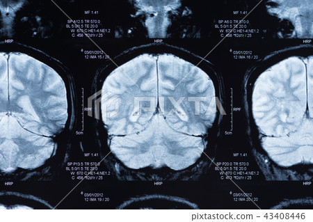 brain scan brain scan 43408446