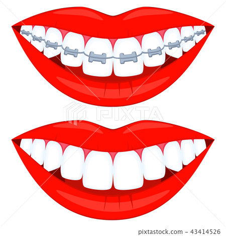 Colorful cartoon teeth aligning elements set 43414526
