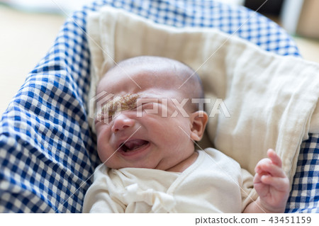 哭泣的新生嬰兒濕疹 43451159