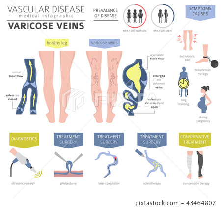 vene varicoase vasculare)