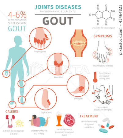 Joints diseases. Gout infographic - Stock Illustration [43464823] - PIXTA