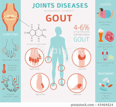 Joints diseases. Gout infographic 43464824