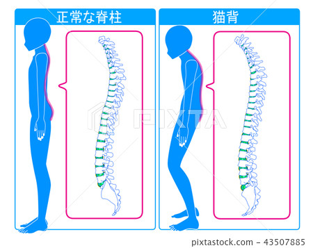 正常脊柱和貓高度比較 正常脊柱和貓高度比較 43507885