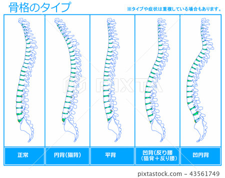 骨架類型1(藍色) 骨架類型1(藍色) 43561749