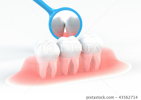 牙齒衛生學CG的例證 43562714
